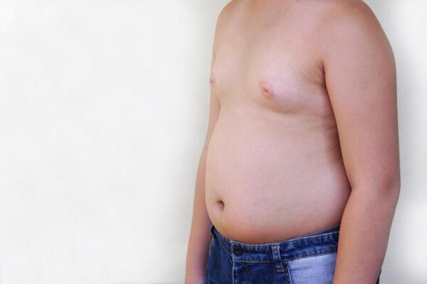 All you need to Know about Gynecomastia