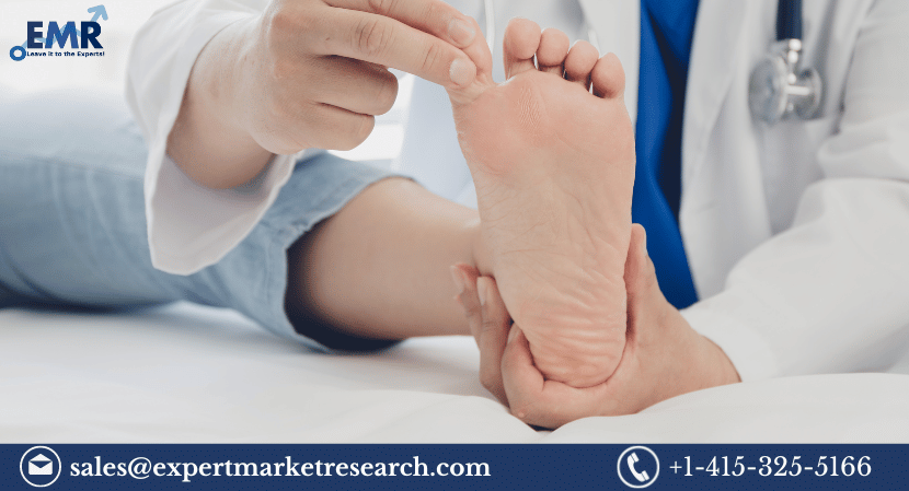 Athlete’s Foot Treatment Market
